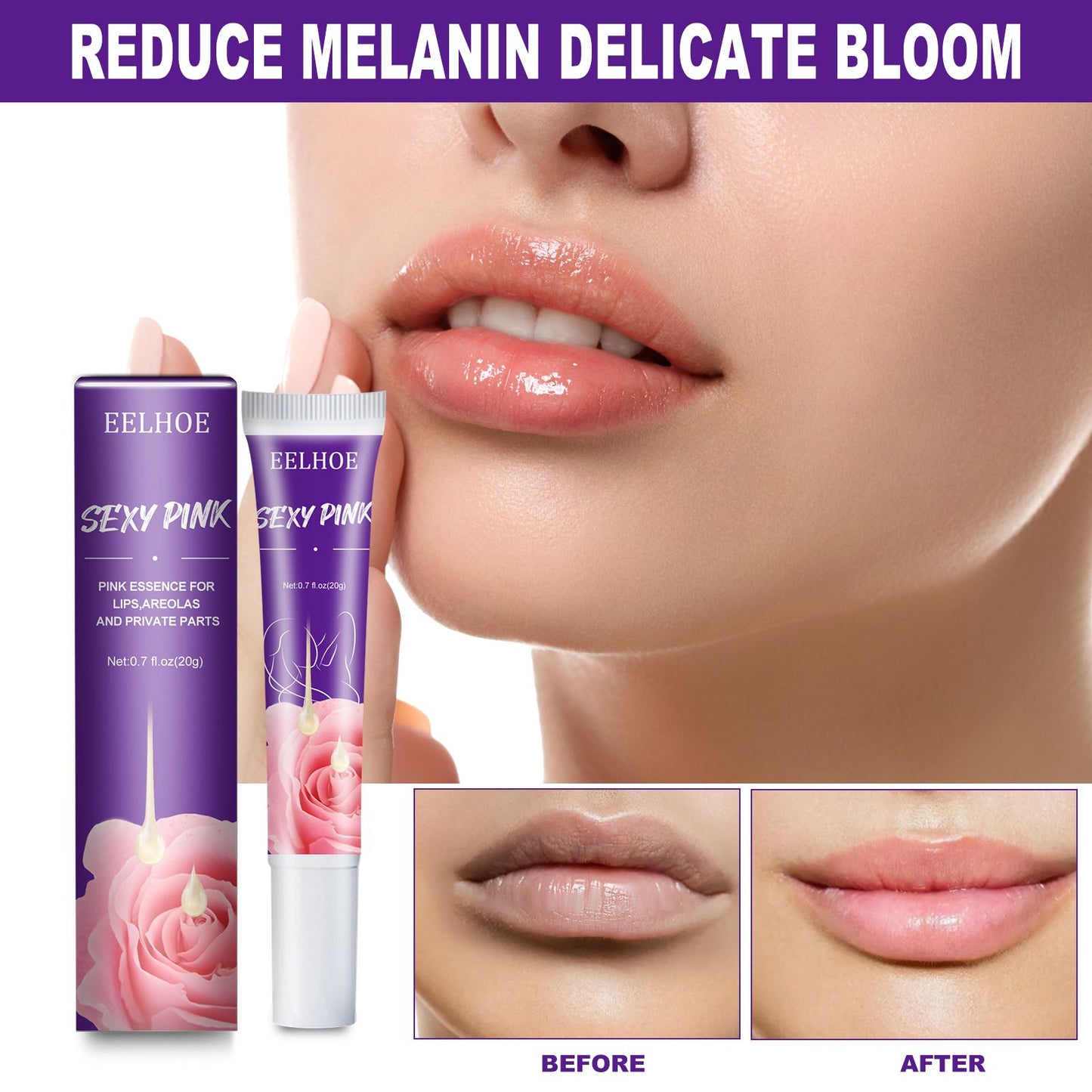 EELHOE Rejuvenator Areola Intimate Area Rejuvenator Lip Joints Melanin Removal