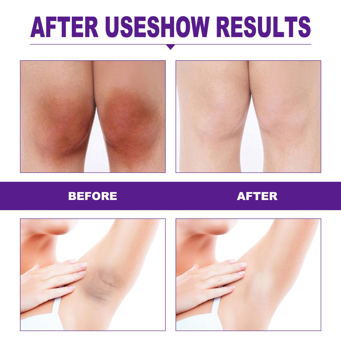 EELHOE Rejuvenator Areola Intimate Area Rejuvenator Lip Joints Melanin Removal