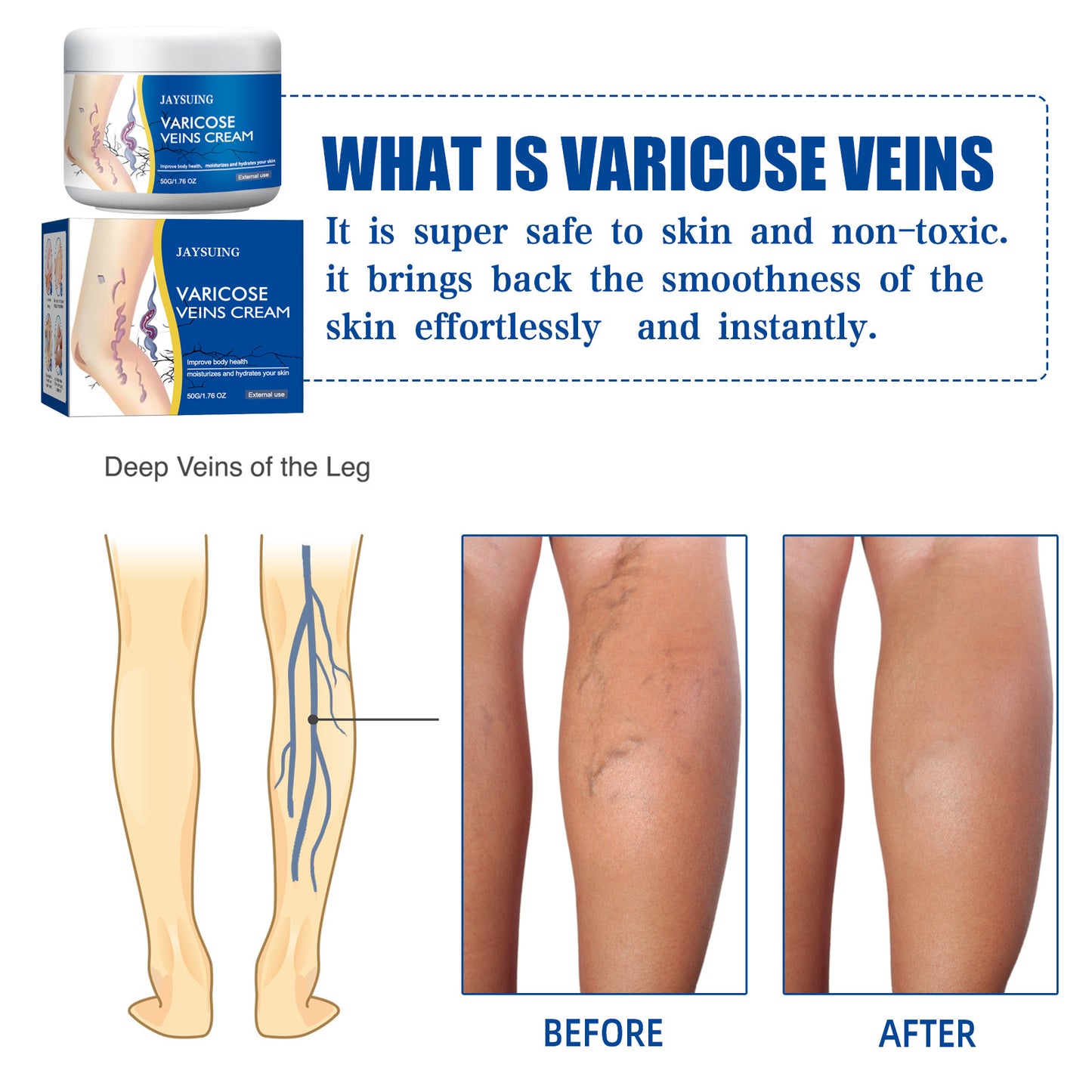 Leg Vein Repair Cream Varicose Massage Earthworm Legs